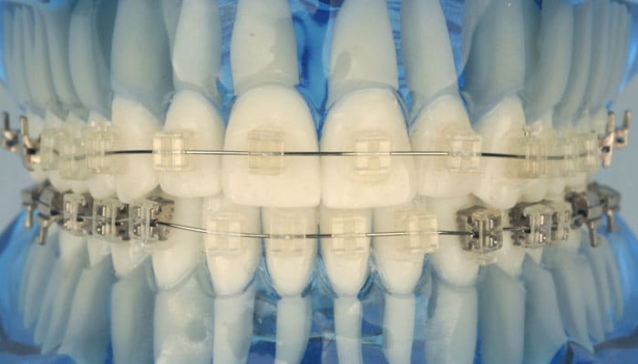 Bioingeniería aplicada a la clínica de ortodoncia Bioingeniería aplicada a la clínica de ortodoncia