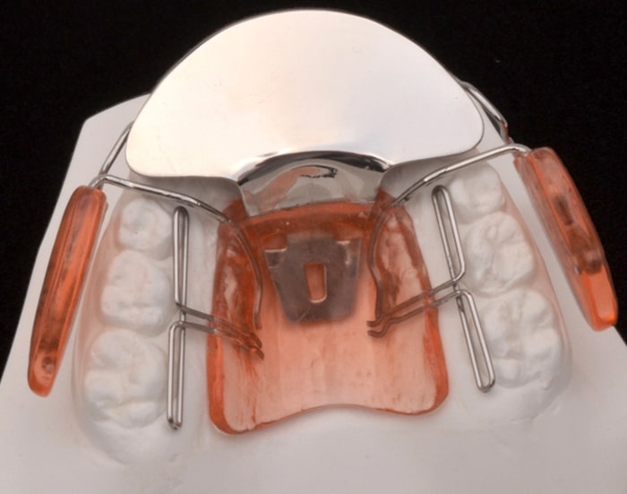 evolucion-tecnica-cervera-cursos-ortodoncia