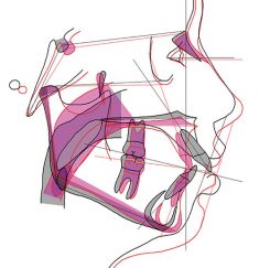 Cefalometría y medios de diagnóstico para el tratamiento Cefalometría y medios de diagnóstico para el tratamiento